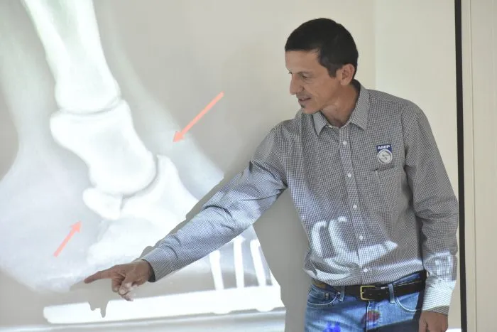 Presenter in a checkered shirt points to a knee X-ray projected on a screen during a medical lecture.